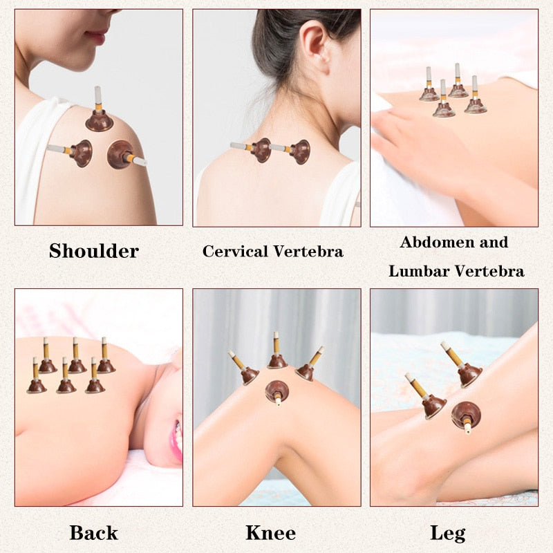 50Pcs Acupuncture Set